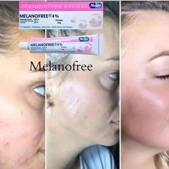 Memanofree crème blanchissante produit original 4